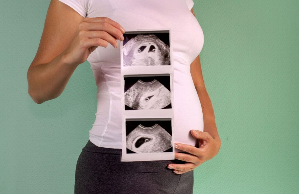 pregnant lady holding ultrasound Images